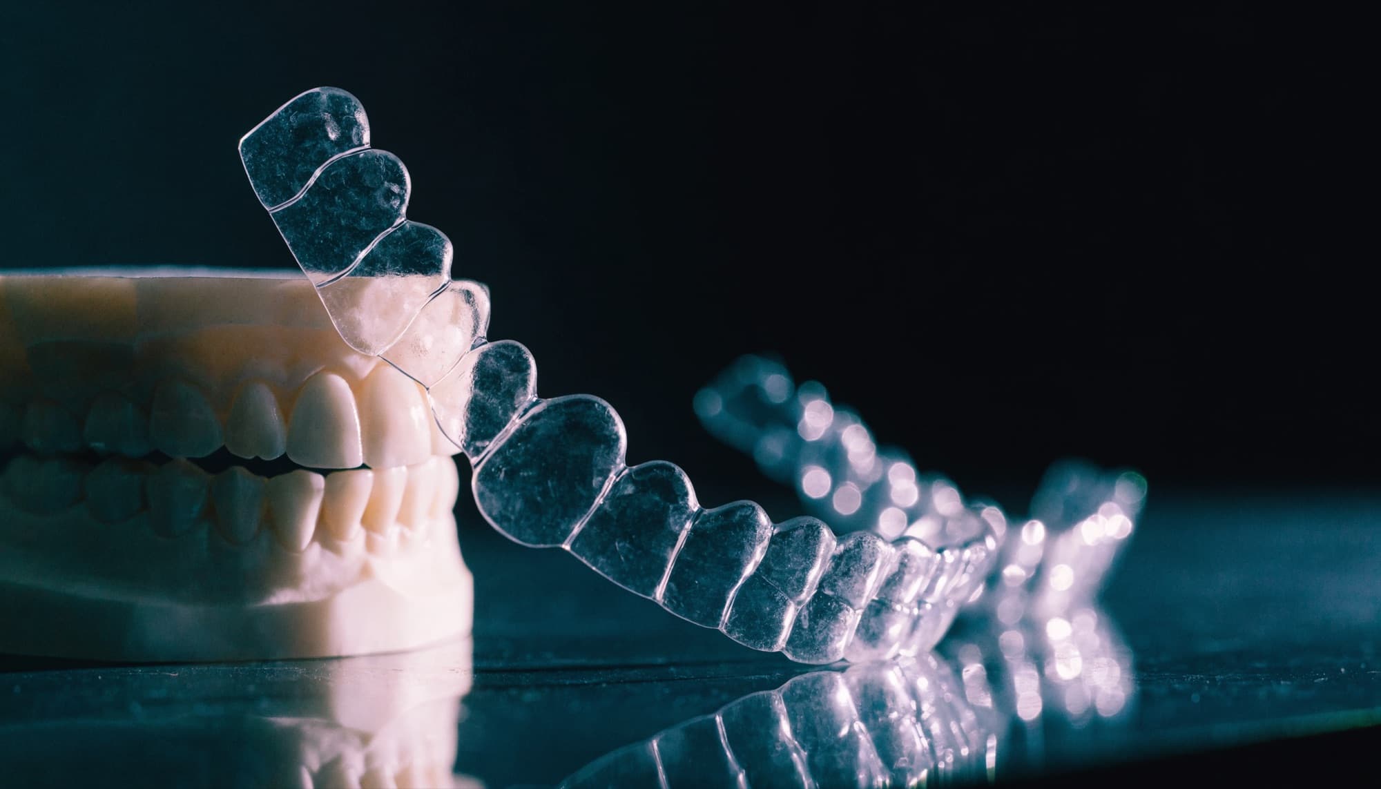 Clear orthodontic aligners and a dental study model on a dark surface